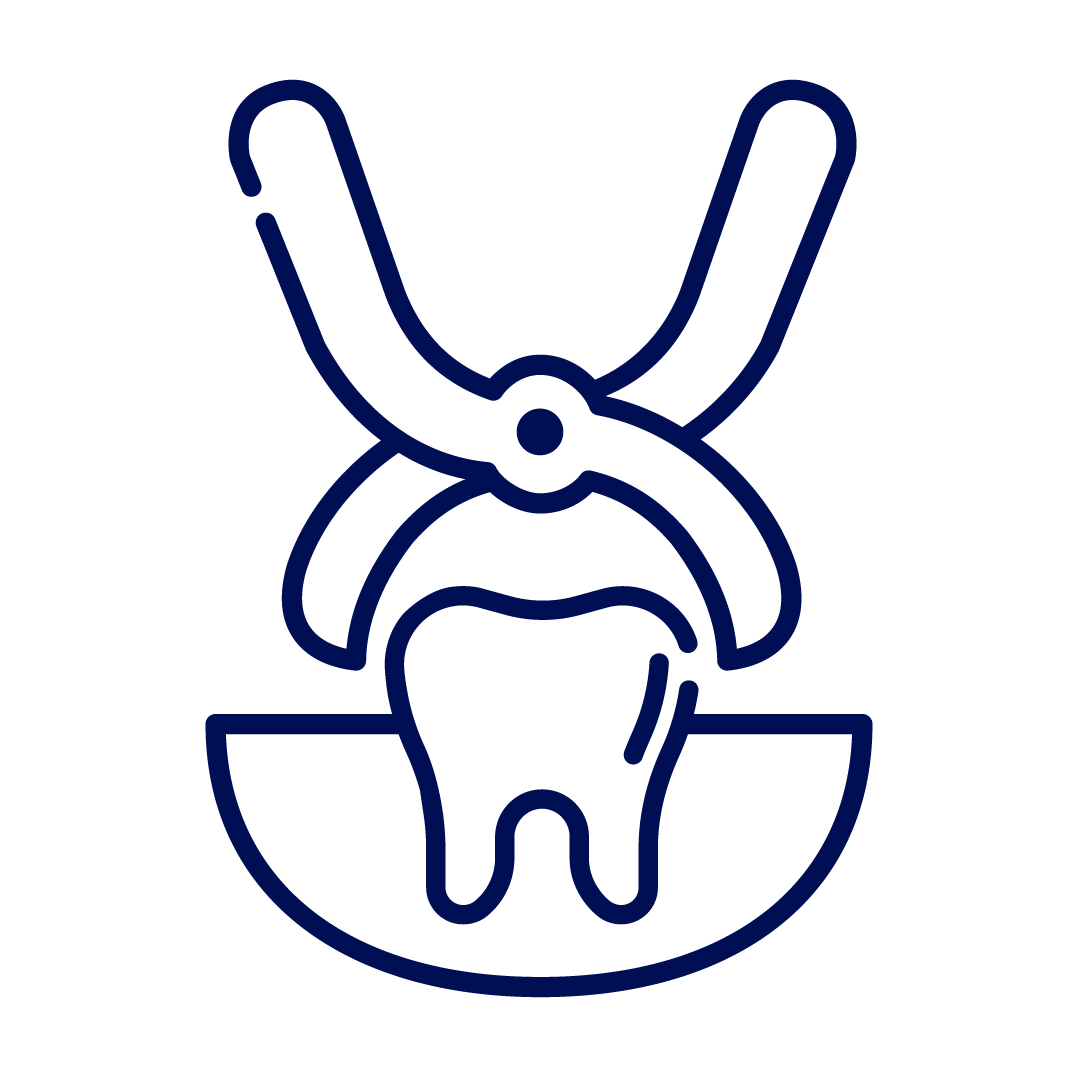 clinica dental pedro montt extraccion dental
