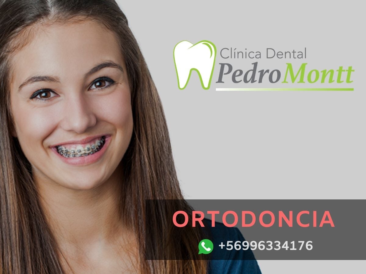 ortodoncia clinica dental pedro montt 