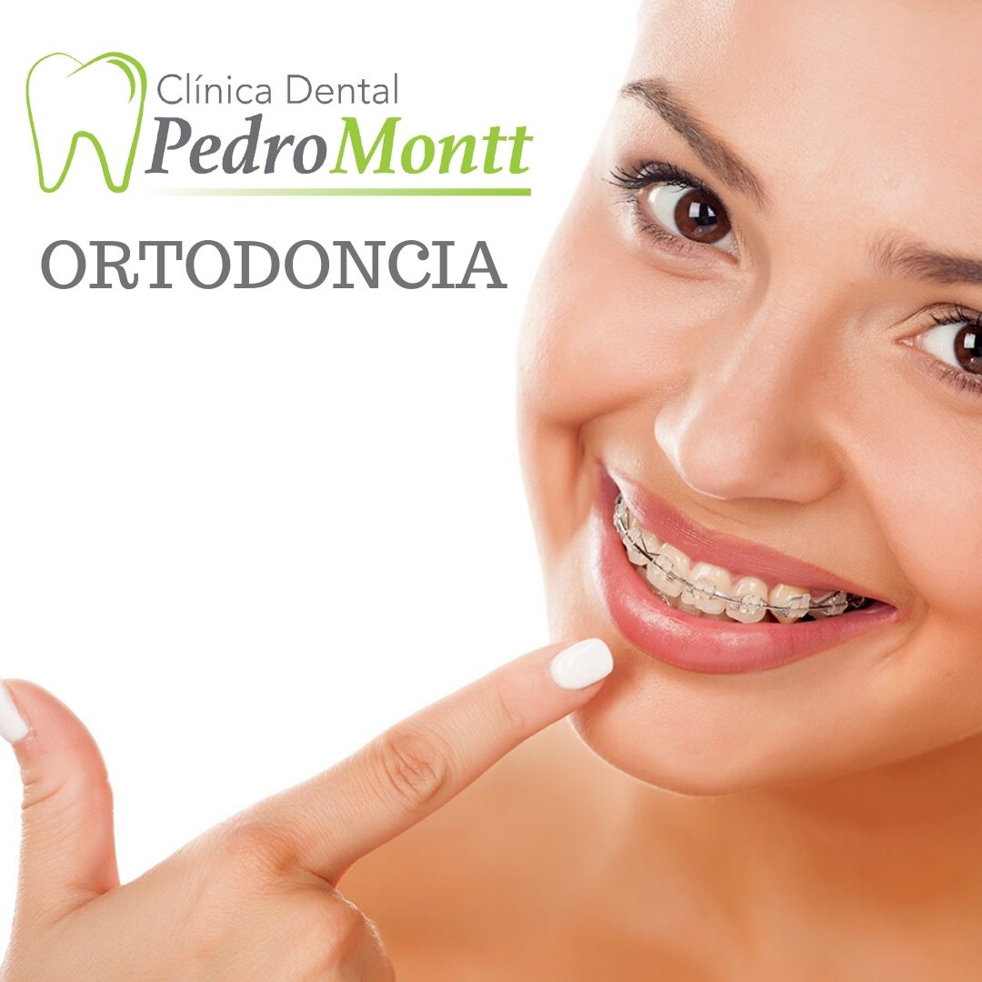 ortodoncia clinica dental pedro montt ancud