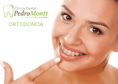 paciente sonriendo con frenillos dentales